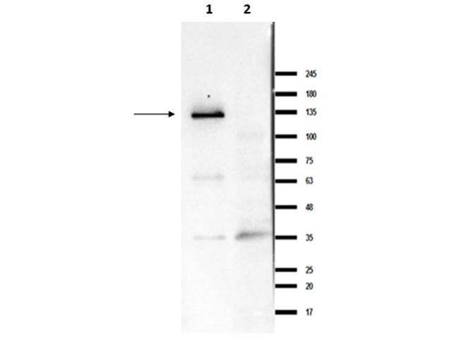 Ire1 Antibody in Western Blot (WB)