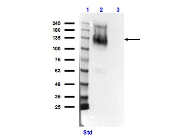 Ire1 Antibody in Western Blot (WB)