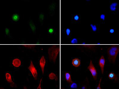 H3K4acT3ph Antibody in Immunocytochemistry (ICC/IF)