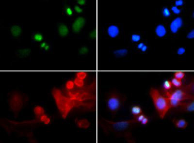 H3K4me3T6ph Antibody in Immunocytochemistry (ICC/IF)