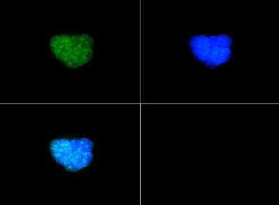 H3K9me2T6ph Antibody in Immunocytochemistry (ICC/IF)