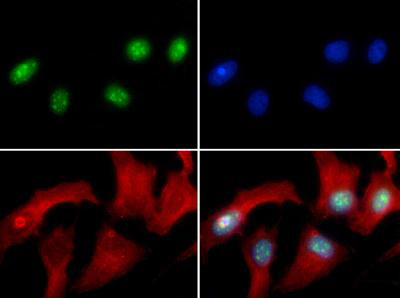 H3R8me2a Antibody in Immunocytochemistry (ICC/IF)