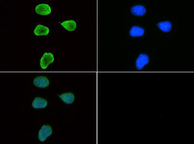 H3K9me3 Antibody in Immunocytochemistry (ICC/IF)