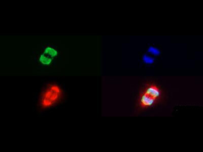 H3K27me3S28ph Antibody in Immunocytochemistry (ICC/IF)