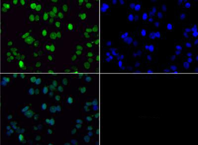 H3K36me2 Antibody in Immunocytochemistry (ICC/IF)