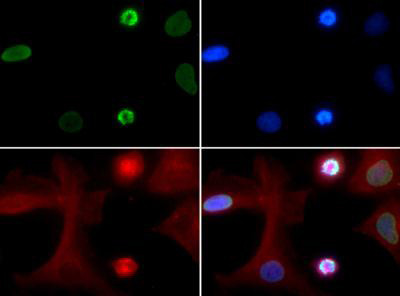 H4K5ac Antibody in Immunocytochemistry (ICC/IF)