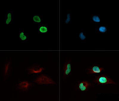 H4K8ac Antibody in Immunocytochemistry (ICC/IF)