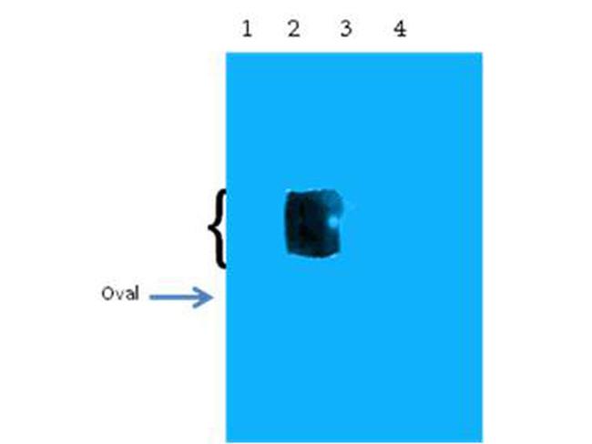 beta Amyloid pyro E11 Antibody in Western Blot (WB)