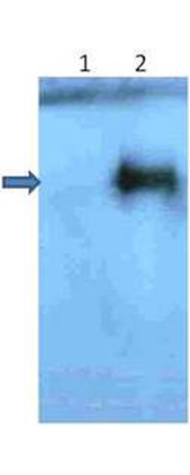 beta Amyloid pyro E3 Antibody in Western Blot (WB)