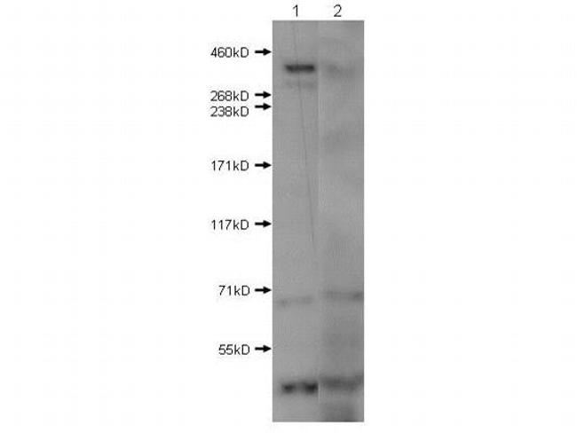 Huntington Antibody in Western Blot (WB)