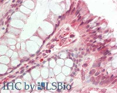 HDAC5 (internal) Antibody in Immunohistochemistry (Paraffin) (IHC (P))