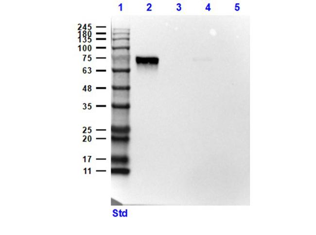 SLC40A1 Antibody in Western Blot (WB)