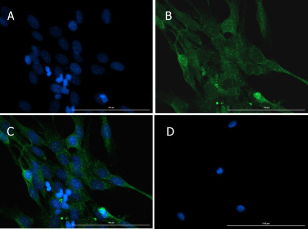 Caspase 12 Antibody in Immunocytochemistry (ICC/IF)