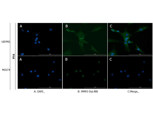 MMP2 Antibody in Immunocytochemistry (ICC/IF)