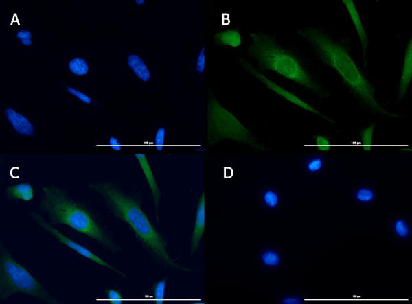 TBK1 Antibody in Immunocytochemistry (ICC/IF)