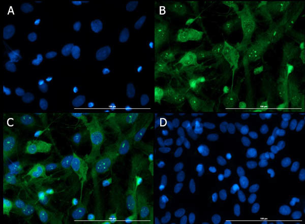 VAChT Antibody in Immunocytochemistry (ICC/IF)