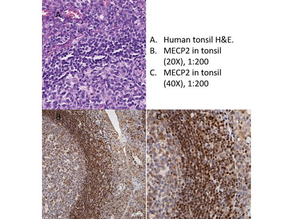 MeCP2 Antibody in Immunohistochemistry (IHC)