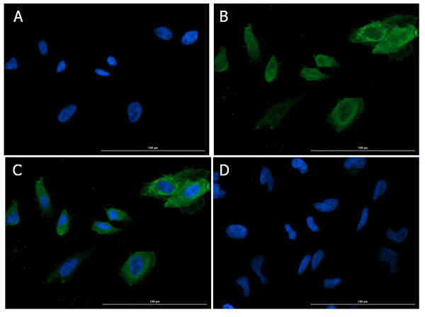 SNAI1 Antibody in Immunocytochemistry (ICC/IF)