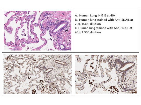 SNAI1 Antibody in Immunohistochemistry (IHC)