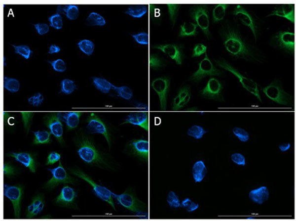 FGFR2 Antibody in Immunocytochemistry (ICC/IF)