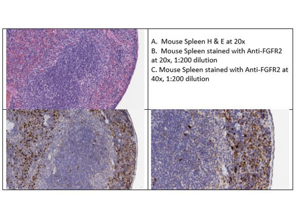 FGFR2 Antibody in Immunohistochemistry (IHC)