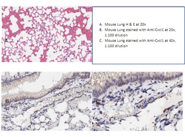 Cxcl1 Antibody in Immunohistochemistry (IHC)