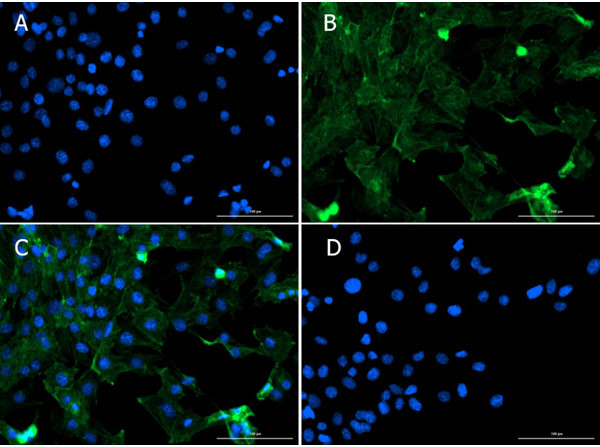 Smad1 Antibody in Immunocytochemistry (ICC/IF)