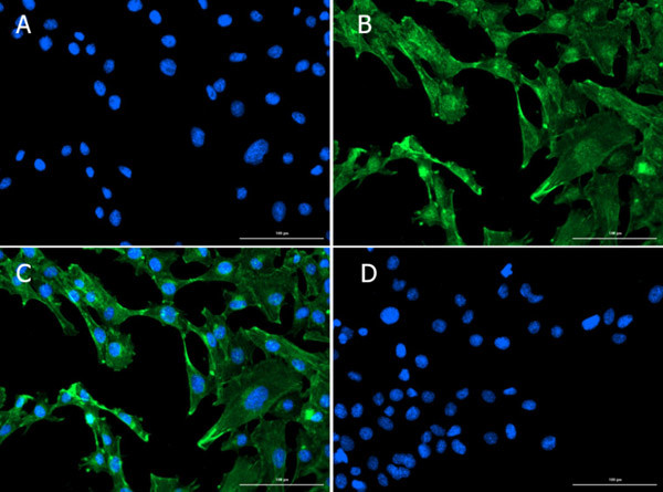 Smad1 Antibody in Immunocytochemistry (ICC/IF)