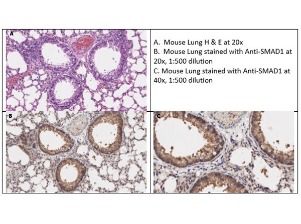 Smad1 Antibody in Immunohistochemistry (IHC)