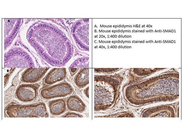 Smad1 Antibody in Immunohistochemistry (IHC)