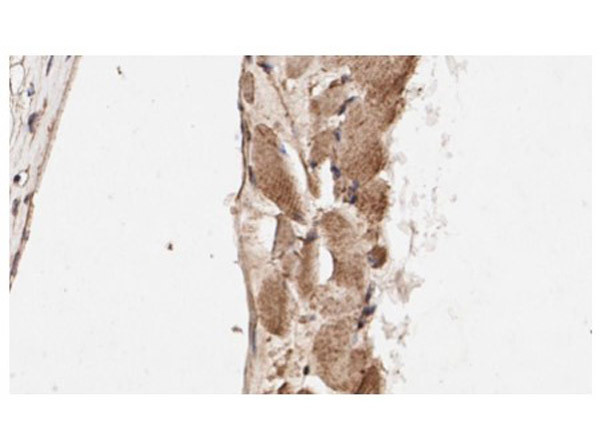 Smad1 Antibody in Immunohistochemistry (IHC)