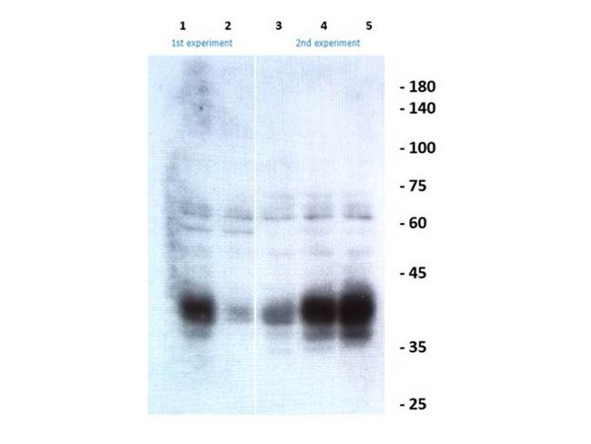 Ephrin B1, B2, B3 Antibody in Western Blot (WB)