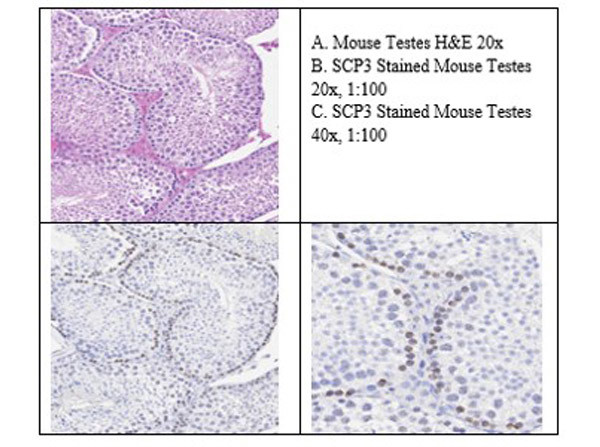 Scp3 Antibody in Immunohistochemistry (IHC)