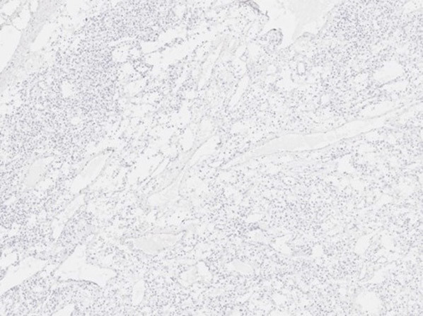 Scp3 Antibody in Immunohistochemistry (IHC)