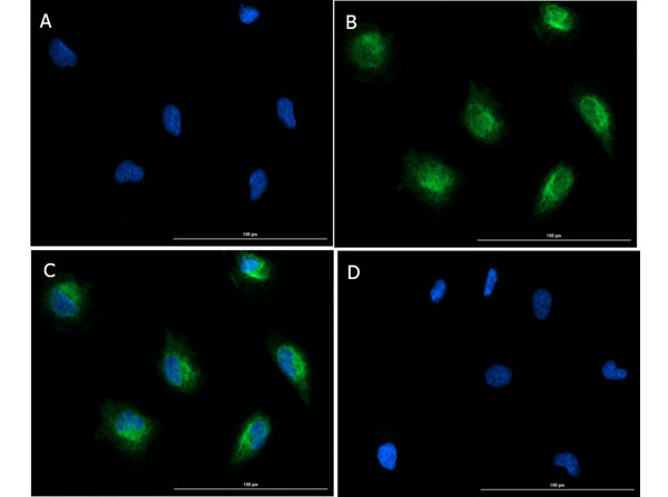 Phospho-SMAD2 (Ser467) Antibody in Immunocytochemistry (ICC/IF)