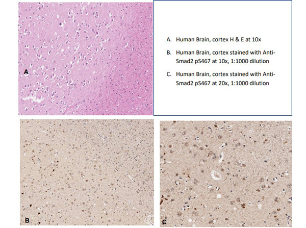 Phospho-SMAD2 (Ser467) Antibody in Immunohistochemistry (IHC)