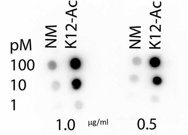 H4K12ac Antibody in Dot Blot (DB)