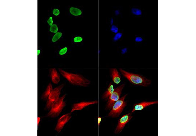 H4K12ac Antibody in Immunocytochemistry (ICC/IF)