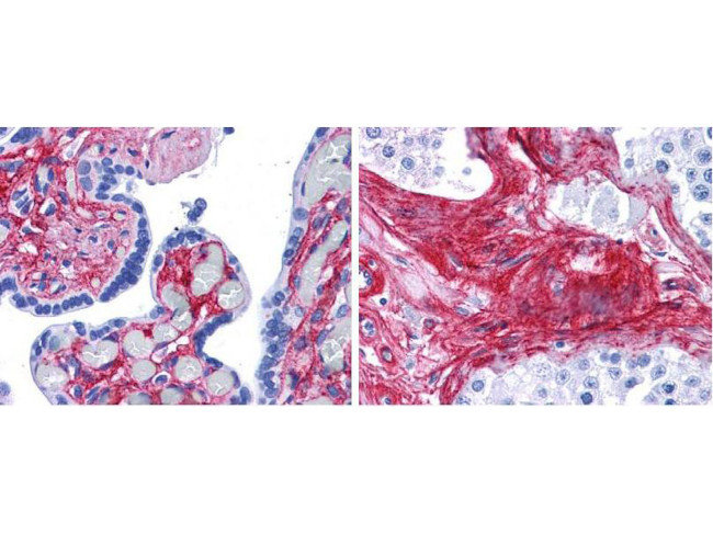 Collagen Type VI Antibody in Immunohistochemistry (Paraffin) (IHC (P))