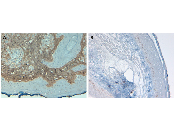 Collagen Type I Antibody in Immunohistochemistry (Paraffin) (IHC (P))