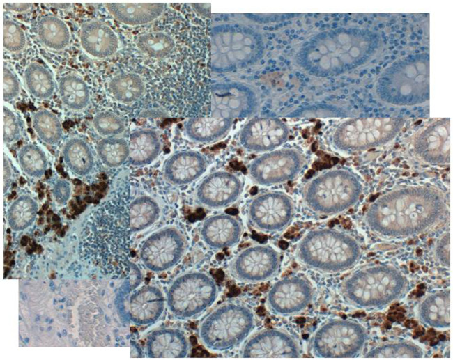 NAG-1 Antibody in Immunohistochemistry (IHC)