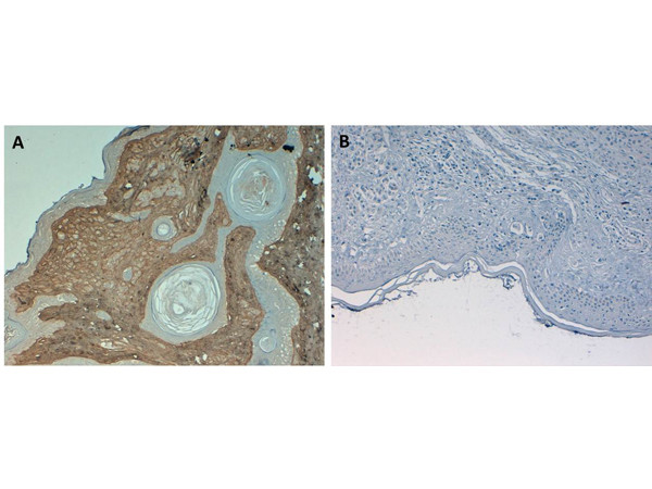 Collagen Type I Antibody in Immunohistochemistry (Paraffin) (IHC (P))