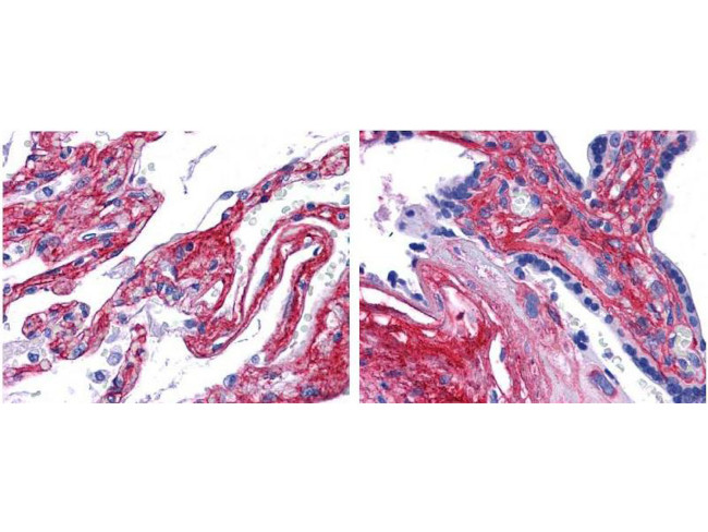 Collagen Type V Antibody in Immunohistochemistry (Paraffin) (IHC (P))