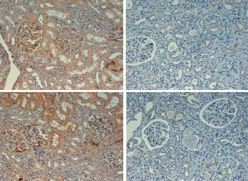 Fibronectin Antibody in Immunohistochemistry (Paraffin) (IHC (P))