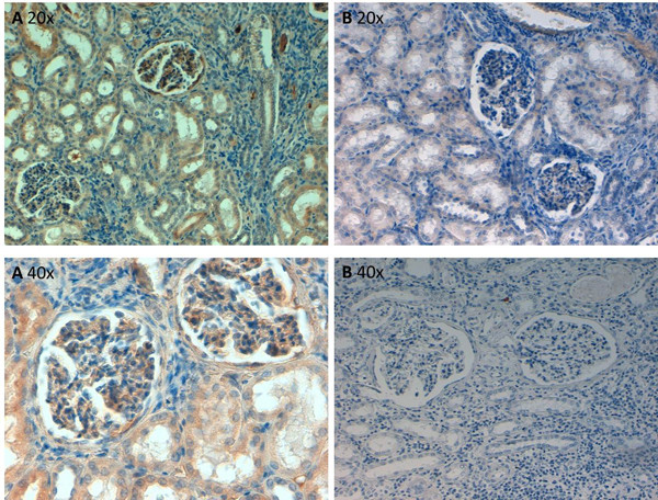 Fibronectin Antibody in Immunohistochemistry (Paraffin) (IHC (P))