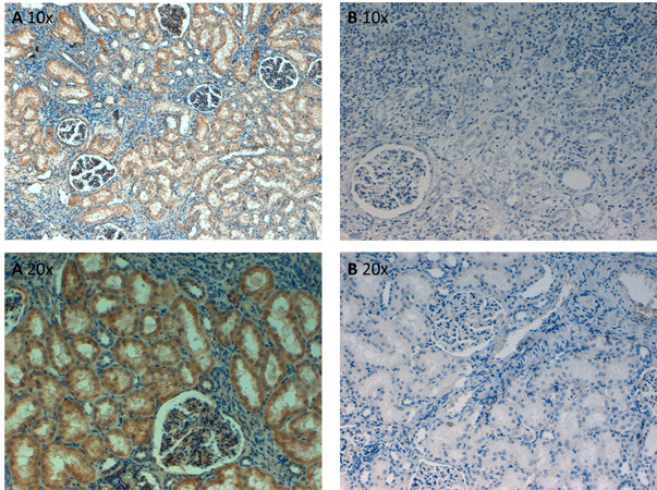 Fibronectin Antibody in Immunohistochemistry (Paraffin) (IHC (P))