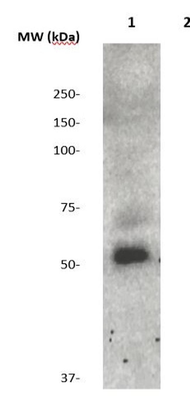 SAPOSIN (PSAP) Antibody in Western Blot (WB)