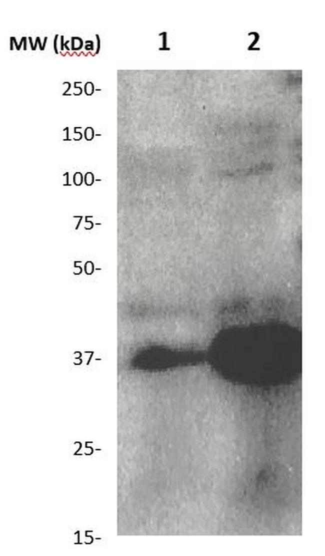 ARG1 Antibody in Western Blot (WB)