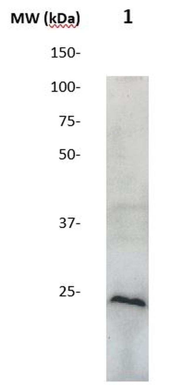 SOCS1 Antibody in Western Blot (WB)