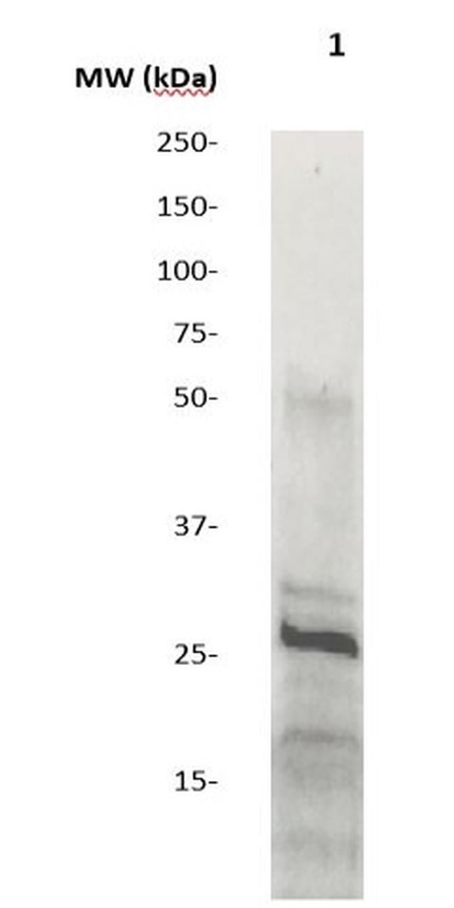 SOCS2 Antibody in Western Blot (WB)